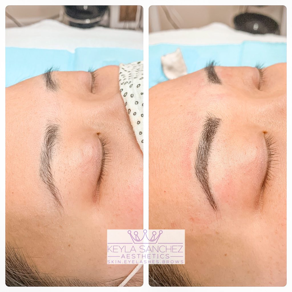 Microblading before and after of an eyebrow Microblading before and after of an eyebrow.