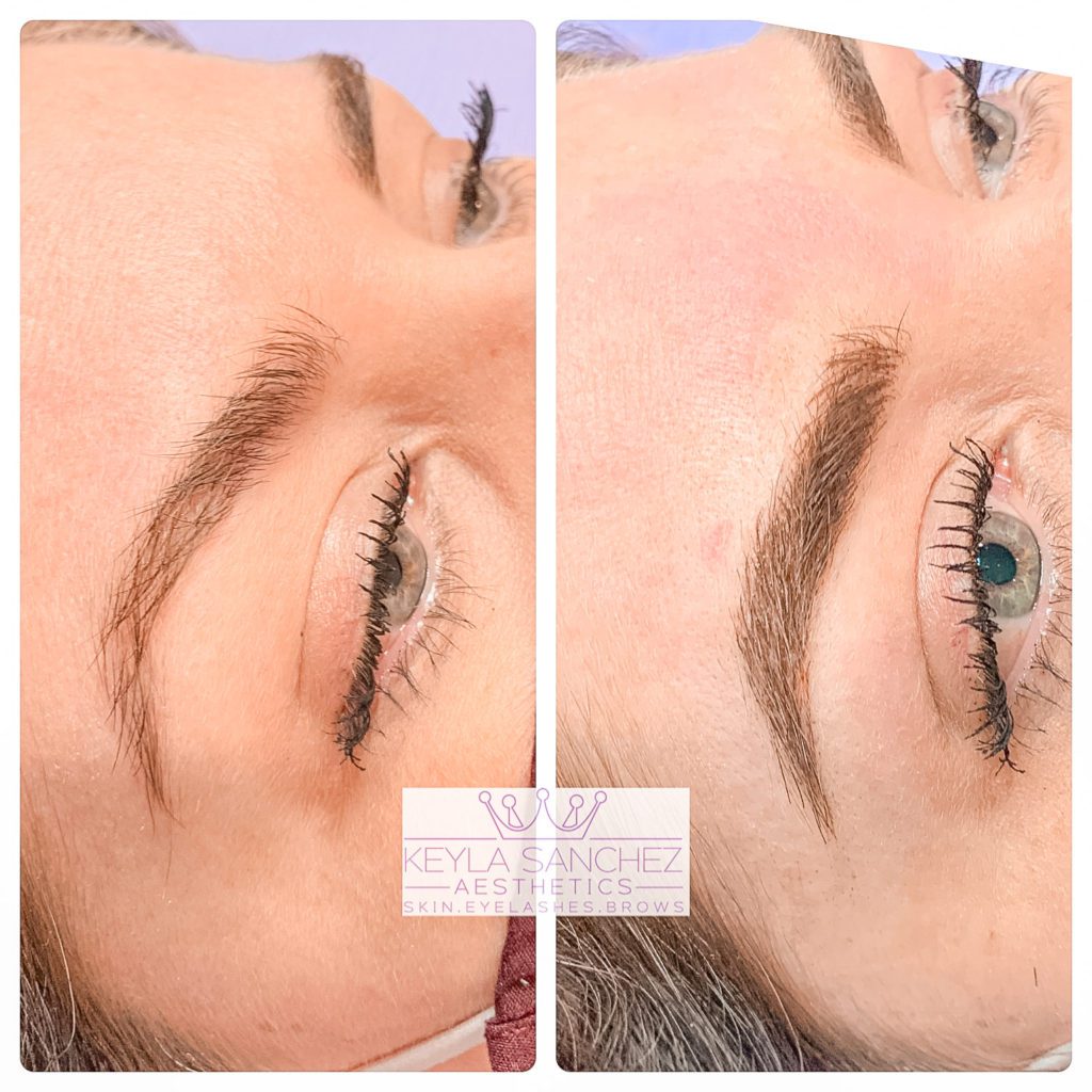 Microblading before and after of an eyebrow Microblading before and after of an eyebrow.