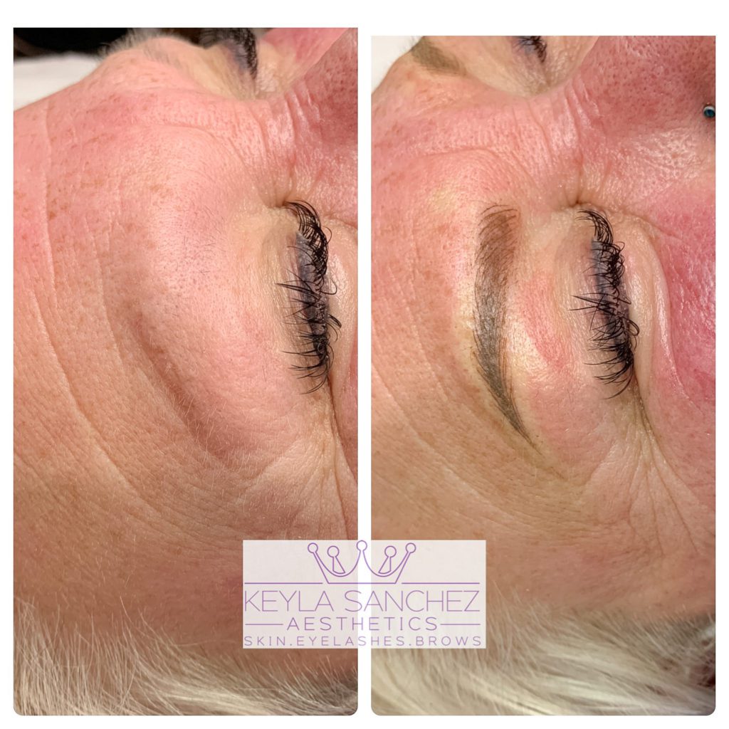 Microblading and shading before and after brow Microblading and shading before and after brow.