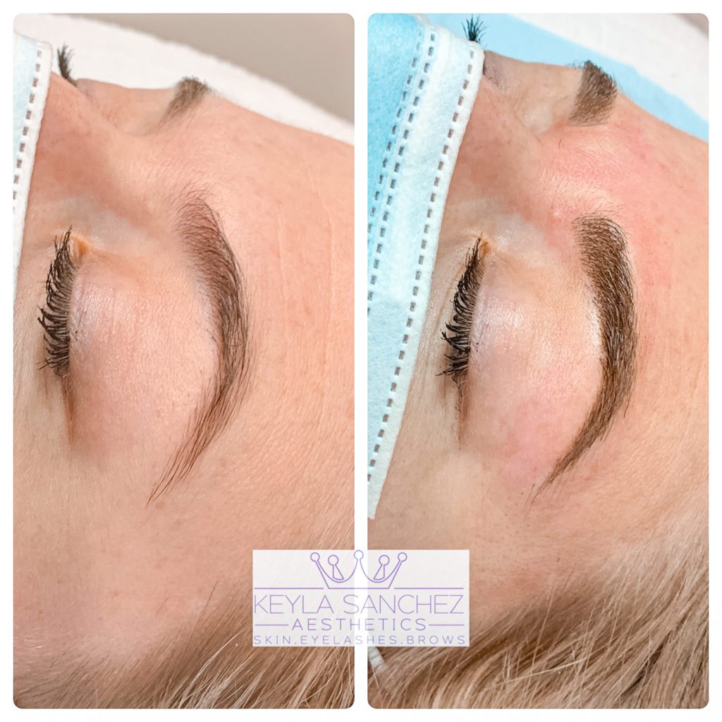 Microblading before and after of an eyebrow Microblading before and after of an eyebrow.