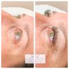 Before and after lash extensions.