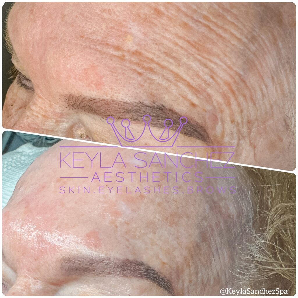 6 months of customized skin treatments 6 months of customized skin treatments.