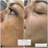 Before and after eyebrow microblading.